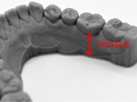 上顎は口蓋最深部、下顎は臼歯歯茎部から1㎝以上スキャンしてください。