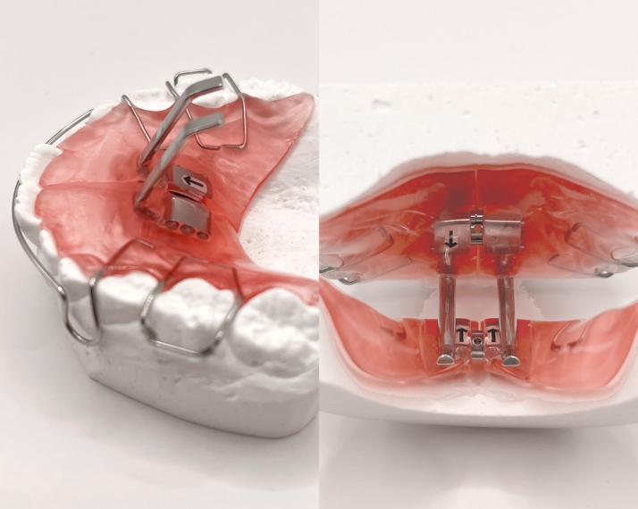 バイトジャンピングアプライアンス（BJA）
