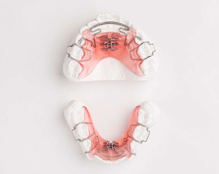 平行拡大（カテナリー付）