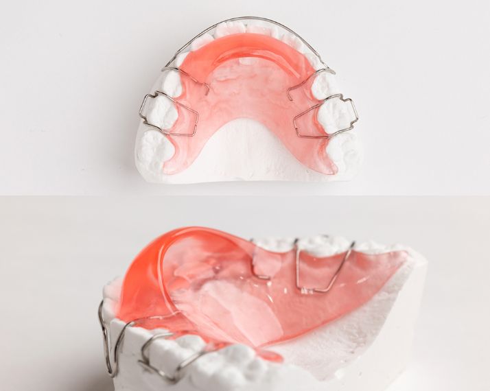 舌癖除去（タング）
