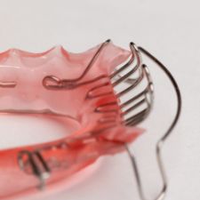 下ワイヤータング