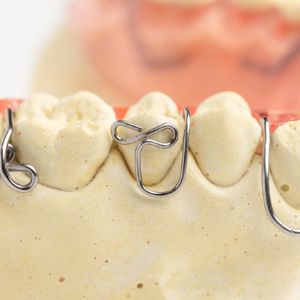 内側移動ワイヤー