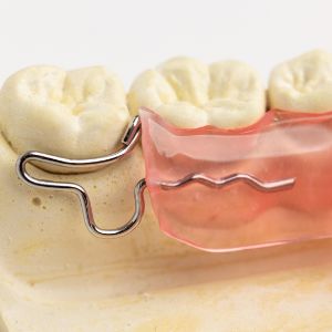 外側移動ワイヤー