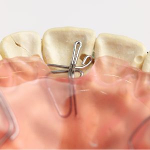 前方スプリング