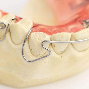 コの字型唇側線