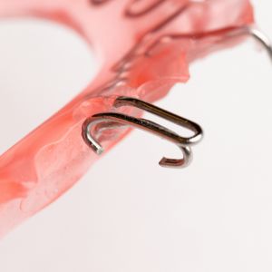 ローレンスクラスプ